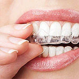 dr william kay prosthodontist boca ration fl services invisalign image